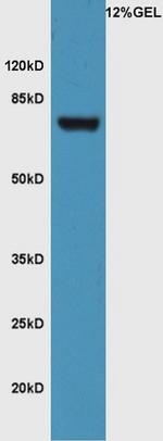 FZD3/Frizzled 3 Antibody in Western Blot (WB)
