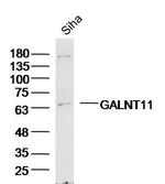 GALNT11/GalNAc-T11 Antibody in Western Blot (WB)