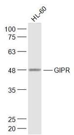 GIPR Antibody in Western Blot (WB)