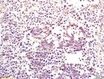 CKIP-1 Antibody in Immunohistochemistry (Paraffin) (IHC (P))
