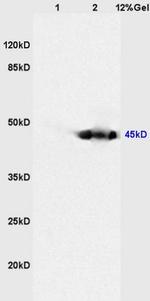 CKIP-1 Antibody in Western Blot (WB)