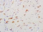 GGA2 Antibody in Immunohistochemistry (Paraffin) (IHC (P))