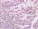 Notch1/MOTC Antibody in Immunohistochemistry (Paraffin) (IHC (P))