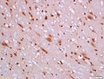 BCL2L1 Antibody in Immunohistochemistry (Paraffin) (IHC (P))