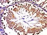GLE1 Antibody in Immunohistochemistry (Paraffin) (IHC (P))