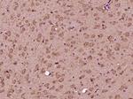 GLT25D2 Antibody in Immunohistochemistry (Paraffin) (IHC (P))