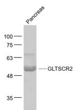 GLTSCR2/PICT1 Antibody in Western Blot (WB)