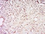 Phospho-Glucocorticoid Receptor (Ser226) Antibody in Immunohistochemistry (Paraffin) (IHC (P))
