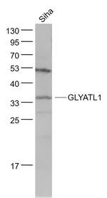 GLYATL1 Antibody in Western Blot (WB)