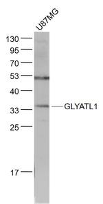 GLYATL1 Antibody in Western Blot (WB)