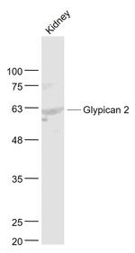Glypican 2/GPC2 Antibody in Western Blot (WB)