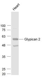 Glypican 2/GPC2 Antibody in Western Blot (WB)