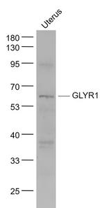 GLYR1/NP60 Antibody in Western Blot (WB)