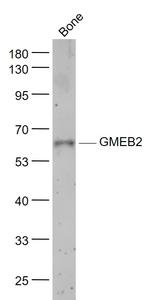 GMEB2 Antibody in Western Blot (WB)