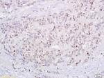 Tp73 protein Antibody in Immunohistochemistry (Paraffin) (IHC (P))
