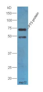 Tp73 protein Antibody in Western Blot (WB)