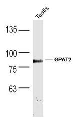 GPAT2 Antibody in Western Blot (WB)