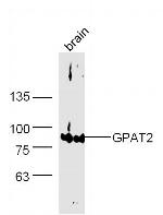 GPAT2 Antibody in Western Blot (WB)