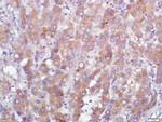 GPR110 Antibody in Immunohistochemistry (Paraffin) (IHC (P))
