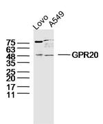 GPR20 Antibody in Western Blot (WB)