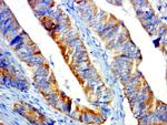 GPR31 Antibody in Immunohistochemistry (Paraffin) (IHC (P))