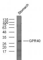 GPR40 Antibody in Western Blot (WB)