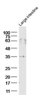 GPR45 Antibody in Western Blot (WB)