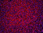 Beclin 1 Antibody in Immunohistochemistry (Paraffin) (IHC (P))