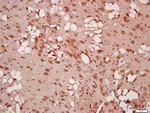 Beclin 1 Antibody in Immunohistochemistry (Paraffin) (IHC (P))