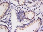 Integrin Alpha V + Beta 5 Antibody in Immunohistochemistry (Paraffin) (IHC (P))
