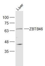 ZBTB46/BTBD4 Antibody in Western Blot (WB)
