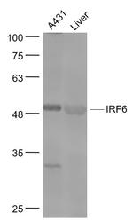 IRF6 Antibody in Western Blot (WB)
