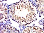 MYCBPAP Antibody in Immunohistochemistry (Paraffin) (IHC (P))