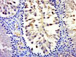 MYCBPAP Antibody in Immunohistochemistry (Paraffin) (IHC (P))