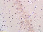 GADD153/DDIT3 Antibody in Immunohistochemistry (Paraffin) (IHC (P))