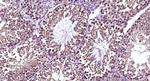 CLEC9A Antibody in Immunohistochemistry (Paraffin) (IHC (P))