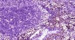 CLEC9A Antibody in Immunohistochemistry (Paraffin) (IHC (P))