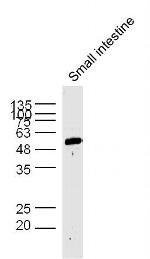 AP1M2 Antibody in Western Blot (WB)