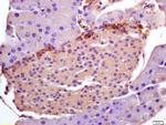 PHLDA1/TDAG51 Antibody in Immunohistochemistry (Paraffin) (IHC (P))