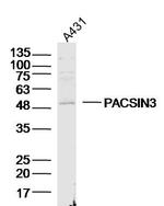 PACSIN3 Antibody in Western Blot (WB)