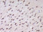 RUSC1 Antibody in Immunohistochemistry (Paraffin) (IHC (P))