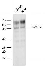WASP Antibody in Western Blot (WB)