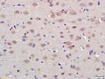 PAG1 Antibody in Immunohistochemistry (Paraffin) (IHC (P))