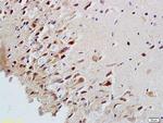 MAP2/MAP-2a.b.c Antibody in Immunohistochemistry (Paraffin) (IHC (P))