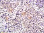 ATM Antibody in Immunohistochemistry (Paraffin) (IHC (P))