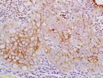 Claudin 10 Antibody in Immunohistochemistry (Paraffin) (IHC (P))