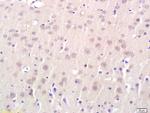 Connexin-32 Antibody in Immunohistochemistry (Paraffin) (IHC (P))