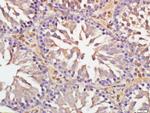 DNAAF3 Antibody in Immunohistochemistry (Paraffin) (IHC (P))