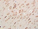 DNAAF3 Antibody in Immunohistochemistry (Paraffin) (IHC (P))