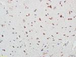 DNAAF3 Antibody in Immunohistochemistry (Paraffin) (IHC (P))